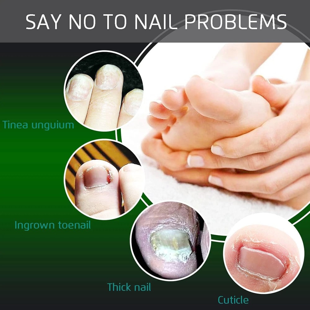 Professional Ingrown Toenail Cuticle Trimmer Clippers Stainless Steel Pedicure Tool For Precision 4