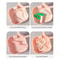 Orthodontic Retainer Holder Storage Box For Dentures And Mouthguard Protection 2