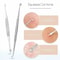 Precision Blackhead Remover Tool Stainless Steel Comedone Extractor Kit 3