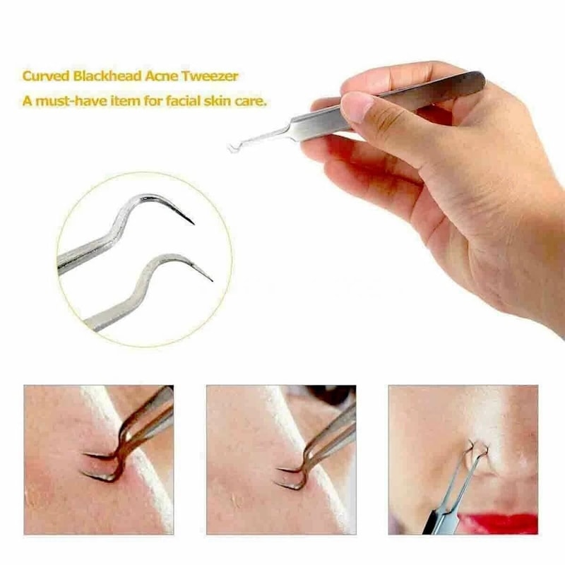 Precision Blackhead Remover Tool Stainless Steel Comedone Extractor Kit 7