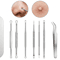 Precision Blackhead Remover Tool Stainless Steel Comedone Extractor Kit 0