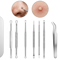 Precision Blackhead Remover Tool Stainless Steel Comedone Extractor Kit 0