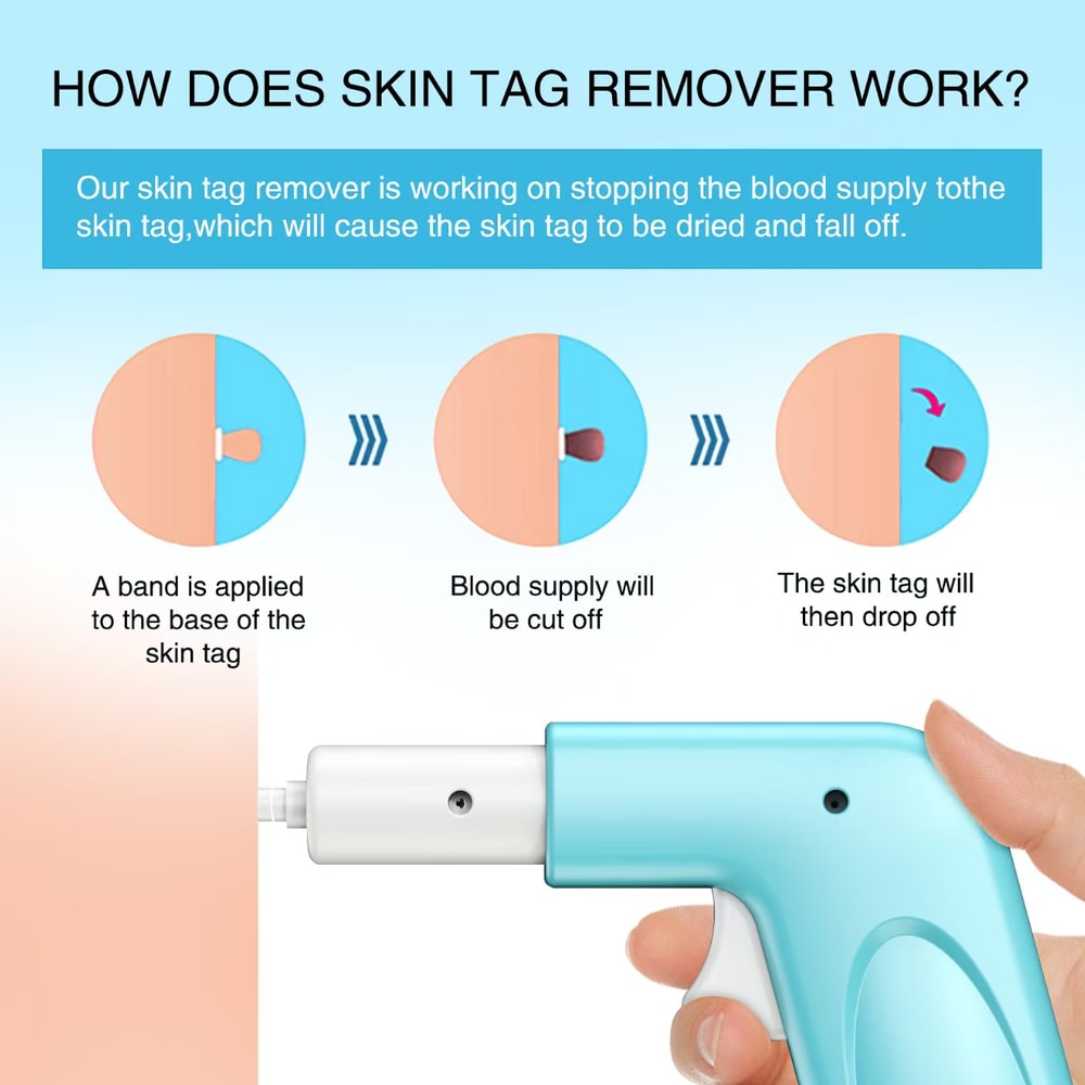 3-in-1 Painless Skin Tag & Mole Removal Kit – Non-Invasive Treatment for Tags & Warts