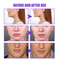 AntiWrinkle Firming Facelift Cream Masseter Muscle Slimming Double Chin Fat Burning VShape Slimming 1