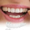 Snap On Teeth Veneers Temporary Dentures For Men And Women Instant Confident Smile Cover Oral Hygie 0