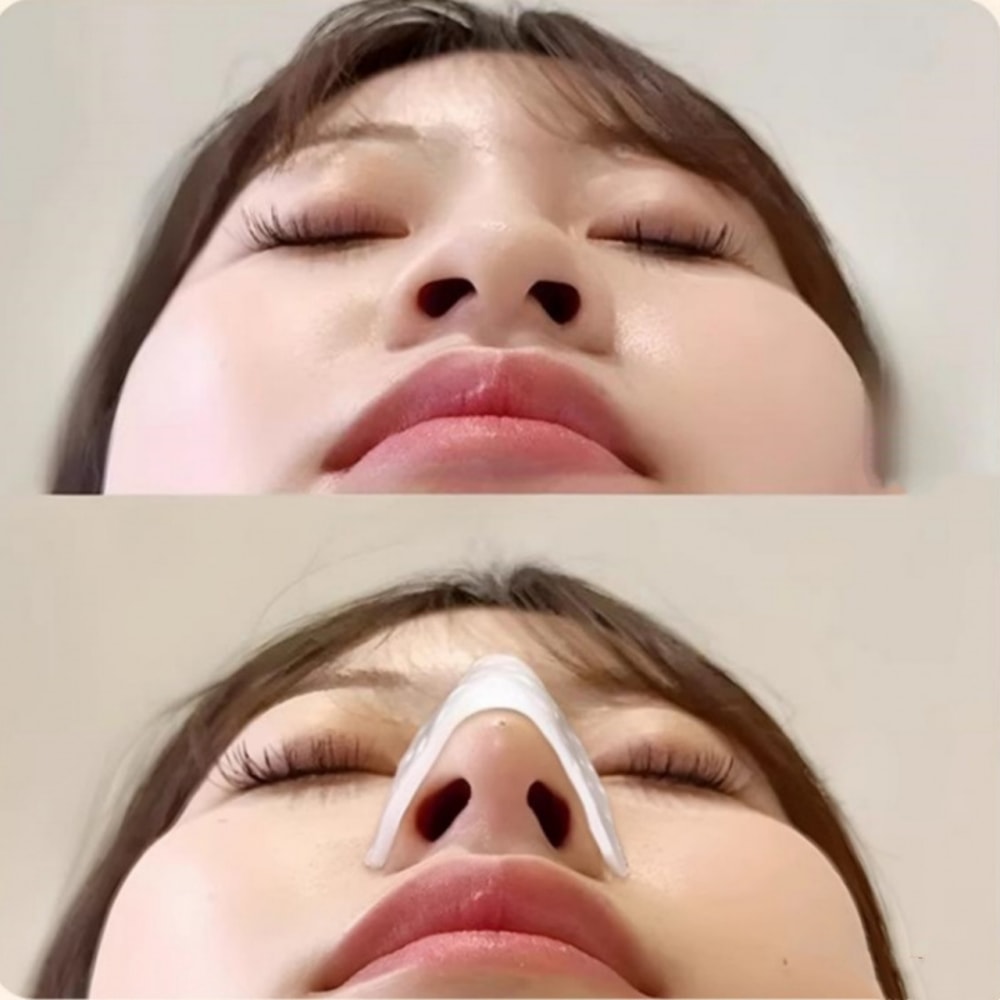 Reusable Self-Pinching Thermoplastic Nose Clip, Nose Beauty Anti-Picking Tool for Shaping