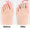Elastic Band Hallux Valgus Corrector for Day and Night Use, Middle Toe Separator for Men and Women