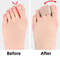 Elastic Band Hallux Valgus Corrector for Day and Night Use, Middle Toe Separator for Men and Women