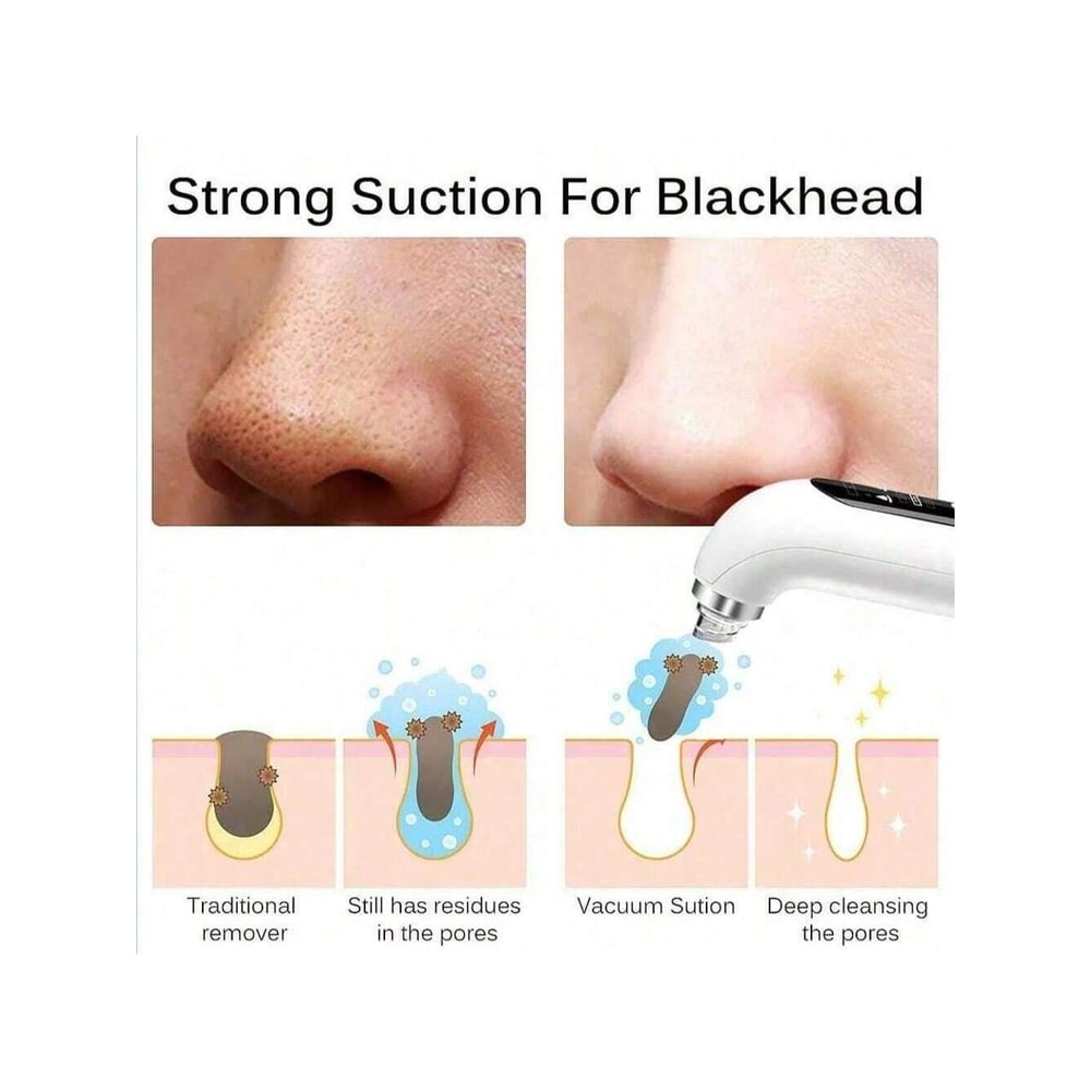 Electric Acne Remover Blackhead Remover Facial Cleaner USB Charging