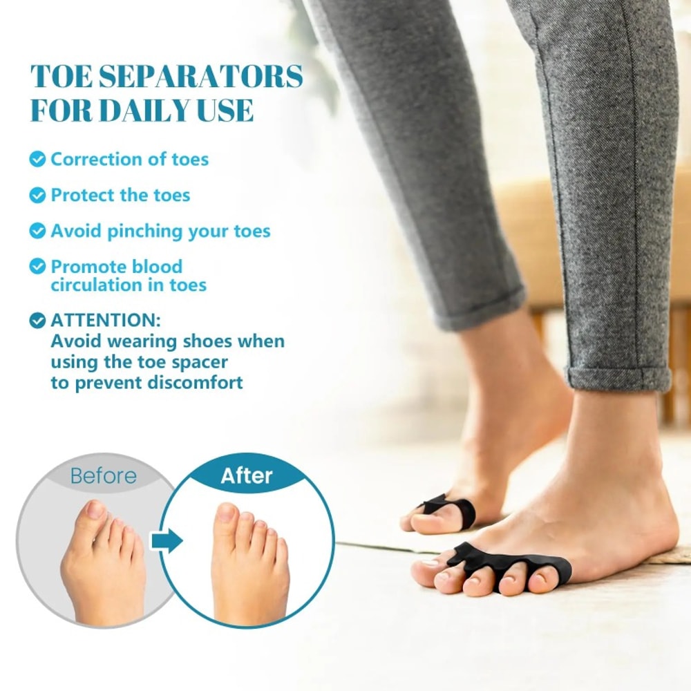 Doctor Recommended Toe Separators for Bunion Pain & Plantar Fasciitis Toe Straightener for Improved Mobility