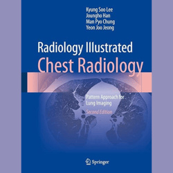 Radiology Illustrated. Chest Radiology. Pattern Approach for Lung Imaging (Lee)