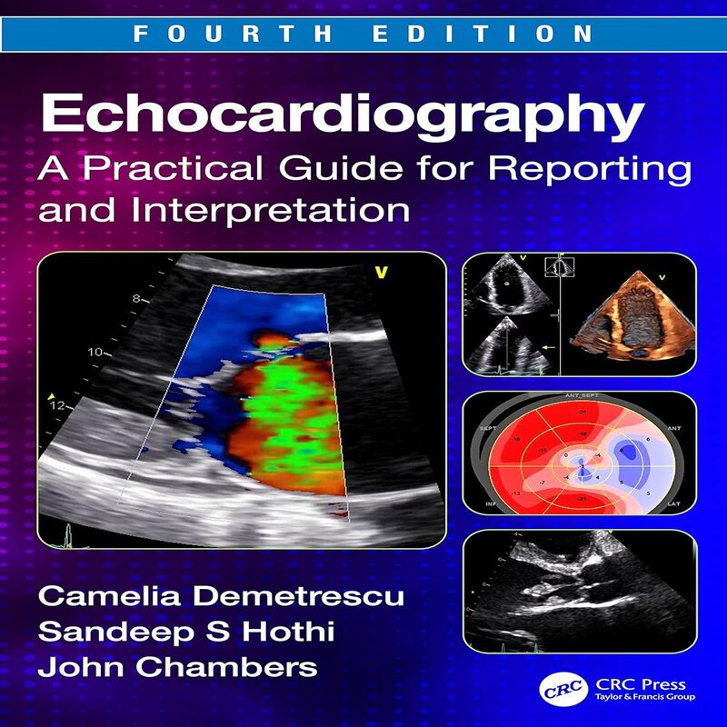 Echo Study Guide Echocardiography: A Practical Guide for Reporting and Interp | Inspire ...