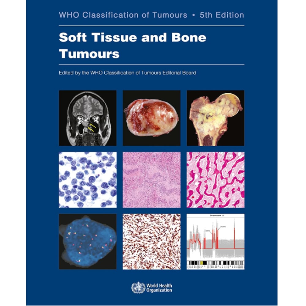 WHO Classification of Tumours (Medicine) 5th Edition.png