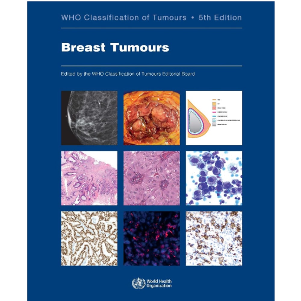WHO Classification of Tumours (Medicine) 5th Edition (1)2.png