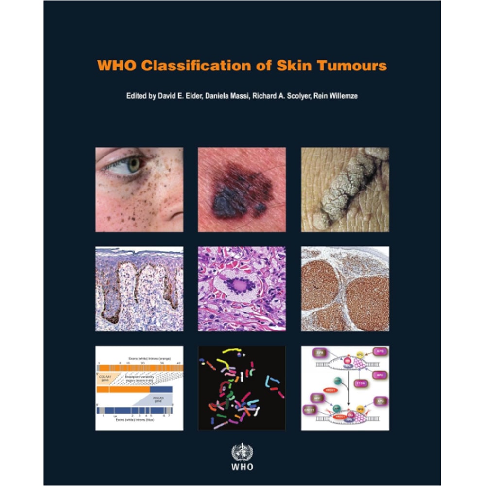 WHO Classification of Skin Tumours (WHO Classification of Tumours) 4th Edition.png