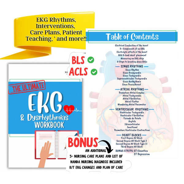 EKG Study Guide for Nursing Students (8).png