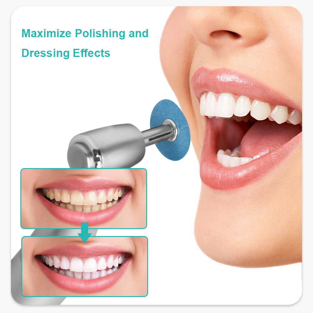 Dental Composite Polishing Discs Gross Reduction  Contouring Mandrel Strips for Ceramics  Glass I