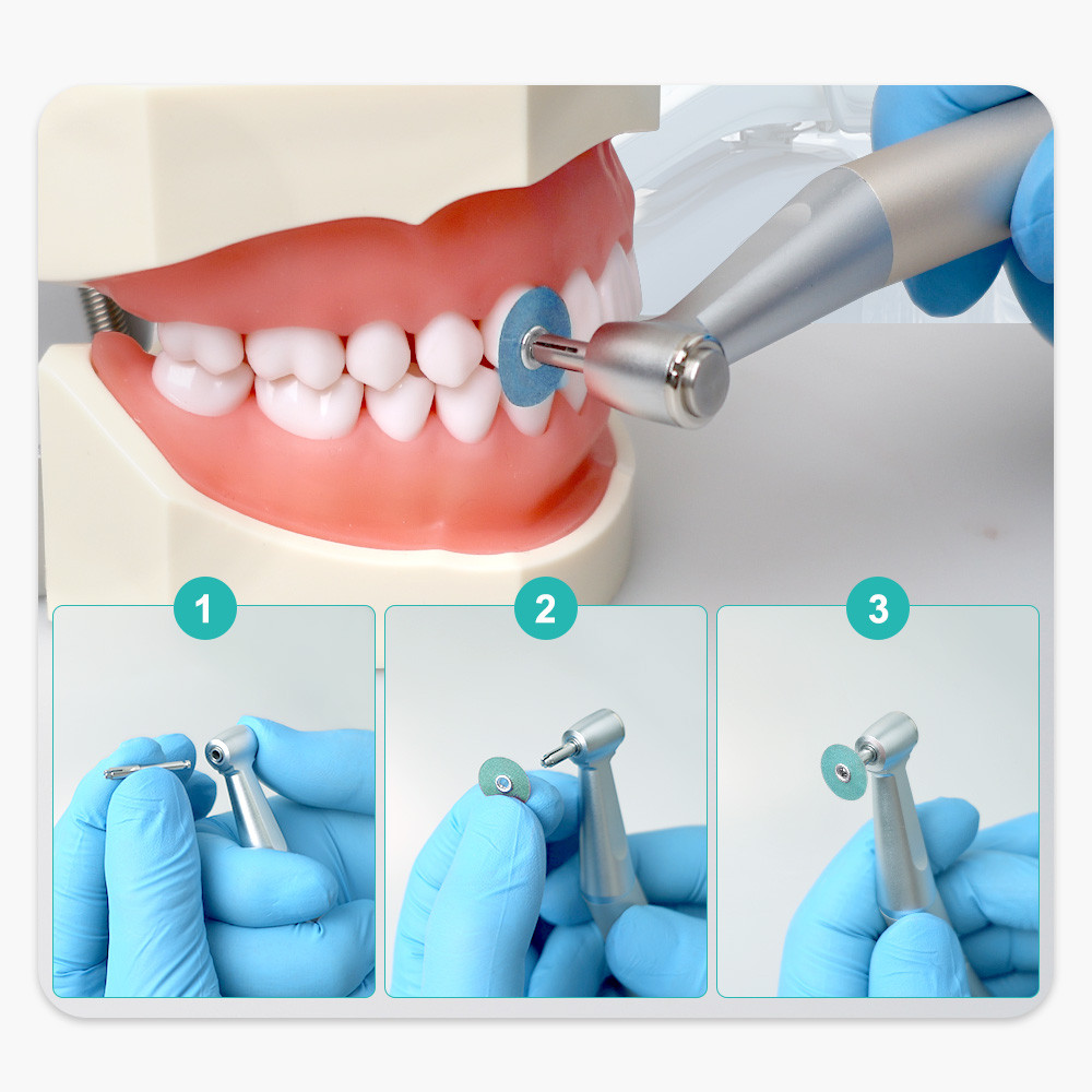 Dental Composite Polishing Discs Gross Reduction  Contouring Mandrel Strips for Ceramics  Glass I