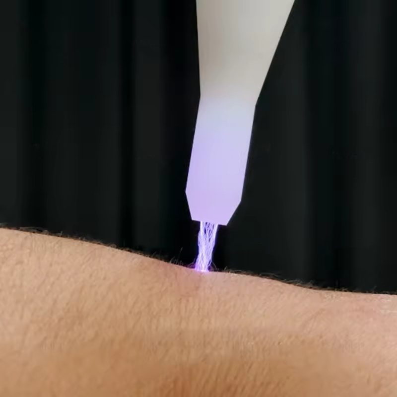 Professional Fusion Plasma Laser Pen with Ozone & Cold Spray, Fibroblast Mole, Wart, Skin Tag Removal & Cold Bleaching