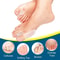 Perfect Soft Big Toe Corrector for Night Use, Long-Term Comfort at Home