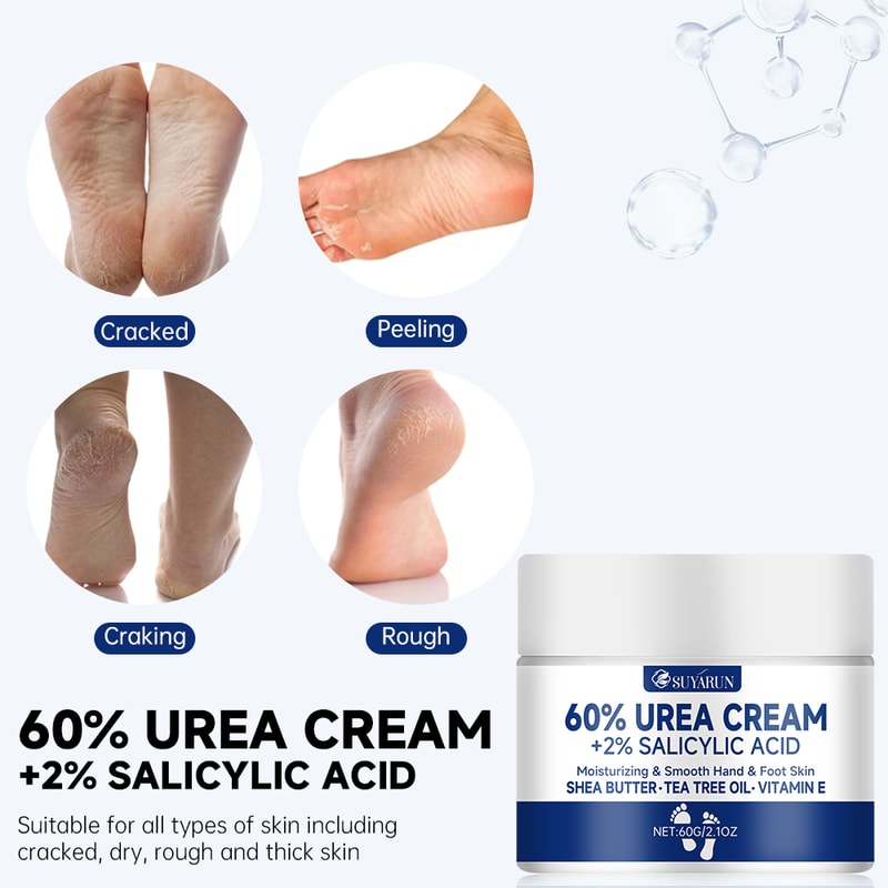 Callus Remover Cream For Cracked Heels Intensive Dry Skin Treatment Diabetic Foot Care Solution 4