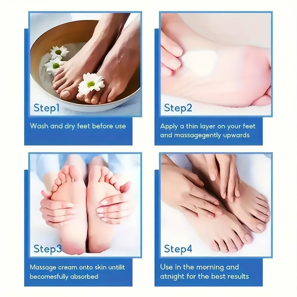 Callus Remover Cream For Cracked Heels Intensive Dry Skin Treatment Diabetic Foot Care Solution 5