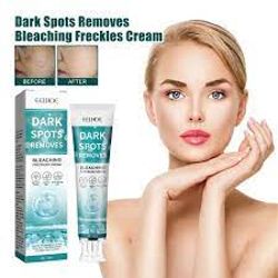 Dark Spots Removal Cream