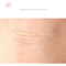 Double Eyelid Adhesive Invisible Lace Eye Lift Strips Style Tape Sticker For Droopy And Hooded Eyel 2