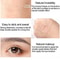 Double Eyelid Adhesive Invisible Lace Eye Lift Strips Style Tape Sticker For Droopy And Hooded Eyel 6