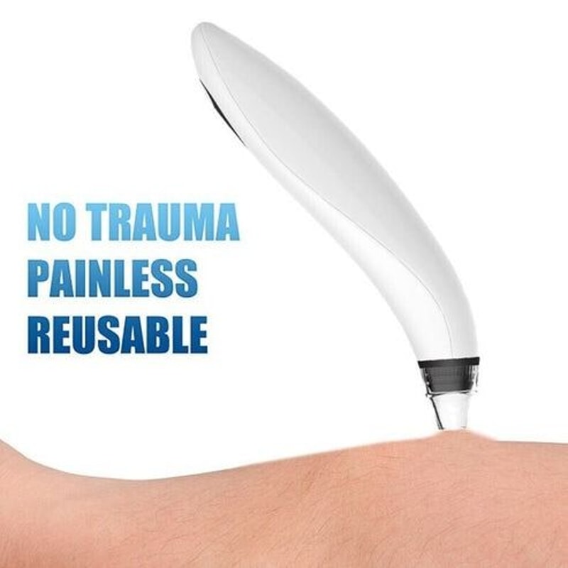 Electric Blackhead Remover Cleaner Pore Vacuum Suction Face Diamond Head For Clear Skin 7