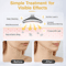 Neck Face Lifting Massager Skin Tighten Device LED Anti Wrinkle Double Chin Treatment Skin Rejuvena 8