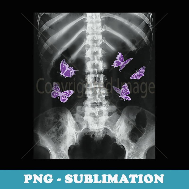 Egirl Xray Skeleton Pink Butterfly Harajuku y2k Dark Grunge - Signature Sublimation PNG File