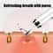 Ultrasonic Skin Scrubber Facial Peeling Device With USB Rechargeable Face Spatula 2