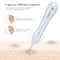 USB Plasma Pen Dark Spot Remover for Freckles Warts and Skin Tags