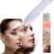USB Plasma Pen Dark Spot Remover for Freckles Warts and Skin Tags