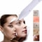 USB Plasma Pen Dark Spot Remover for Freckles Warts and Skin Tags