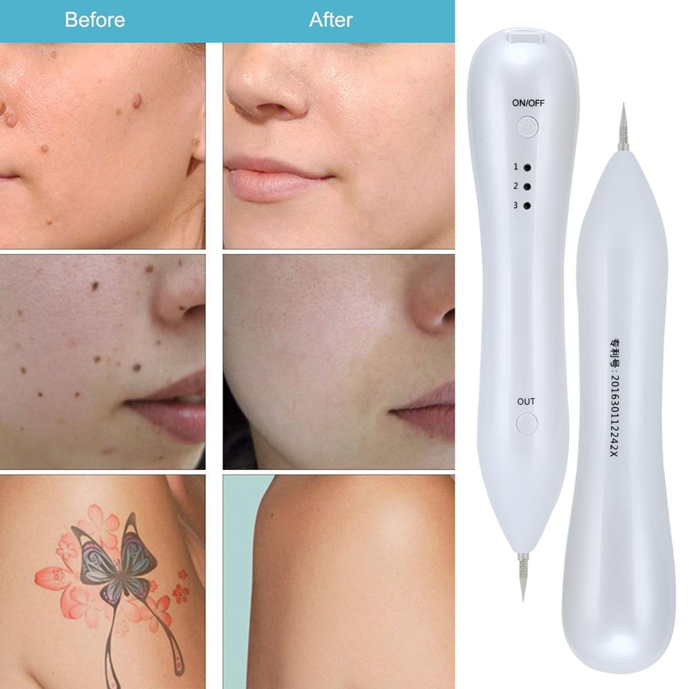 USB Plasma Pen Dark Spot Remover for Freckles Warts and Skin Tags