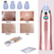 Rechargeable Pore Vacuum Cleaner Blackhead Remover With Diamond Dermabrasion 2