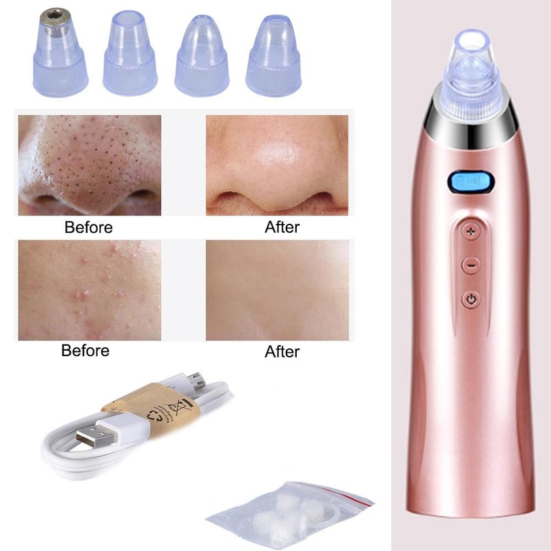 Rechargeable Pore Vacuum Cleaner Blackhead Remover With Diamond Dermabrasion 2