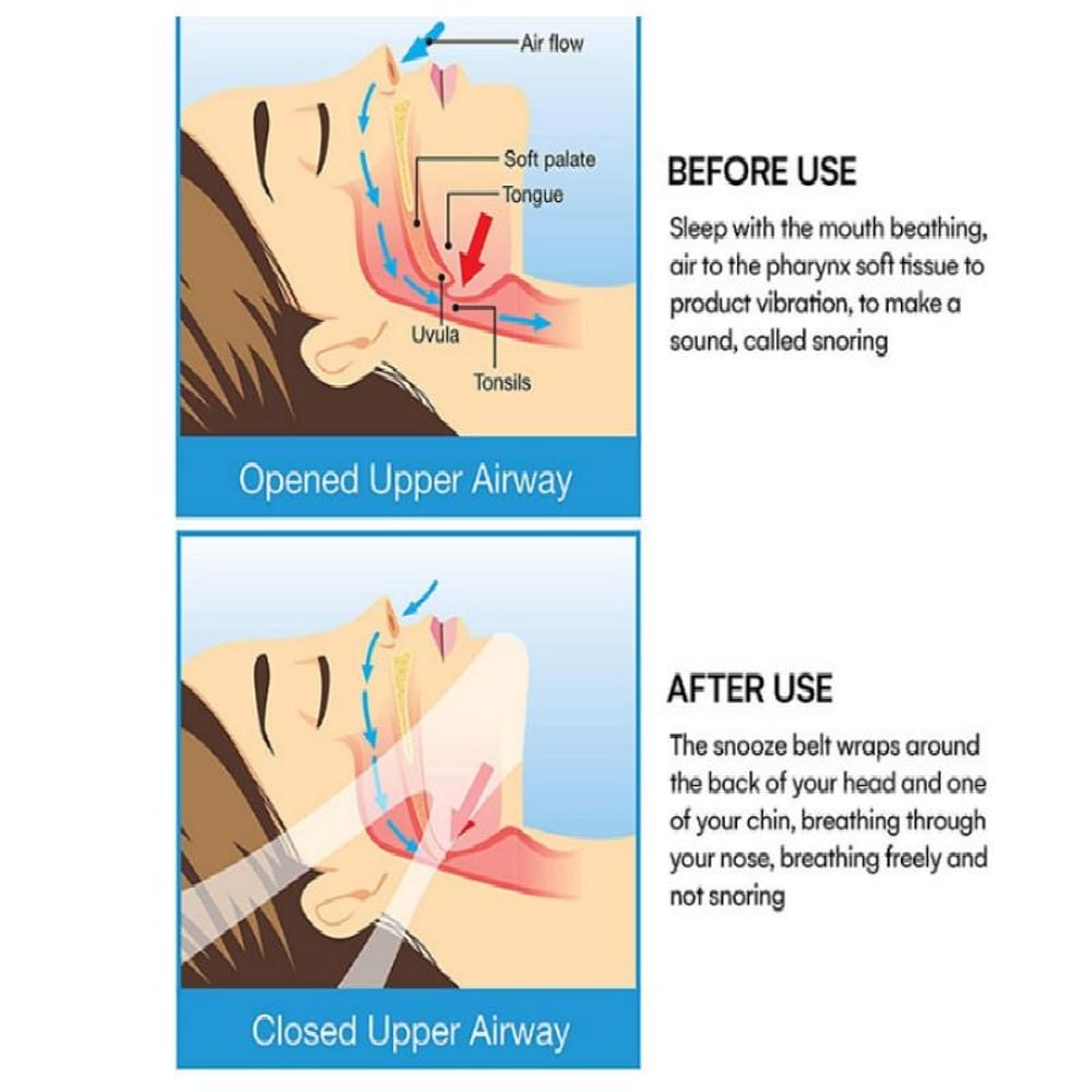 Premium Anti Snoring Chin Strap Comfortable Jaw Support Sleep Snoring Prevention Aid 3