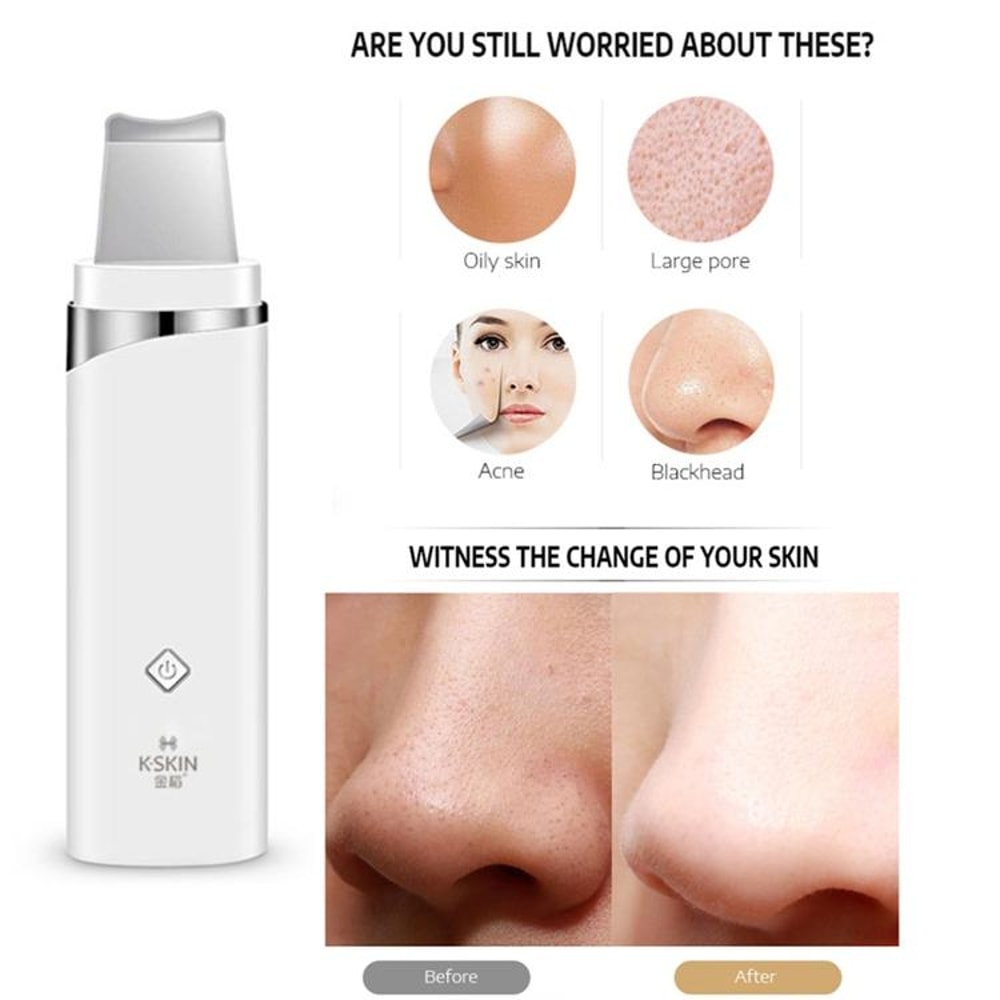 Ultrasonic Skin Scrubber & Blackhead Remover Facial Pore Cleaner Deep Exfoliating Device
