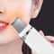 Ultrasonic Skin Scrubber & Blackhead Remover Facial Pore Cleaner Deep Exfoliating Device