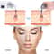 Rechargeable Blackhead Remover Pore Vacuum Facial Cleaner 3