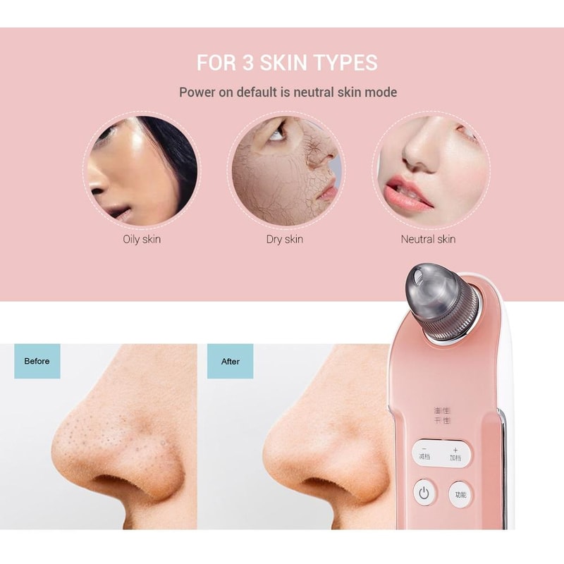 Rechargeable Blackhead Remover Pore Vacuum Facial Cleaner 6