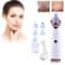 Electric Blackhead Remover Pore Vacuum with Speed Suction and LCD Display