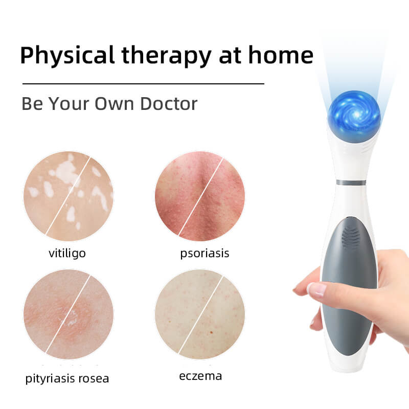 Vitiligo Phototherapy Medical 308nm Uvb Lamp Handheld Light Therapy For Psoriasis Skin Care 1