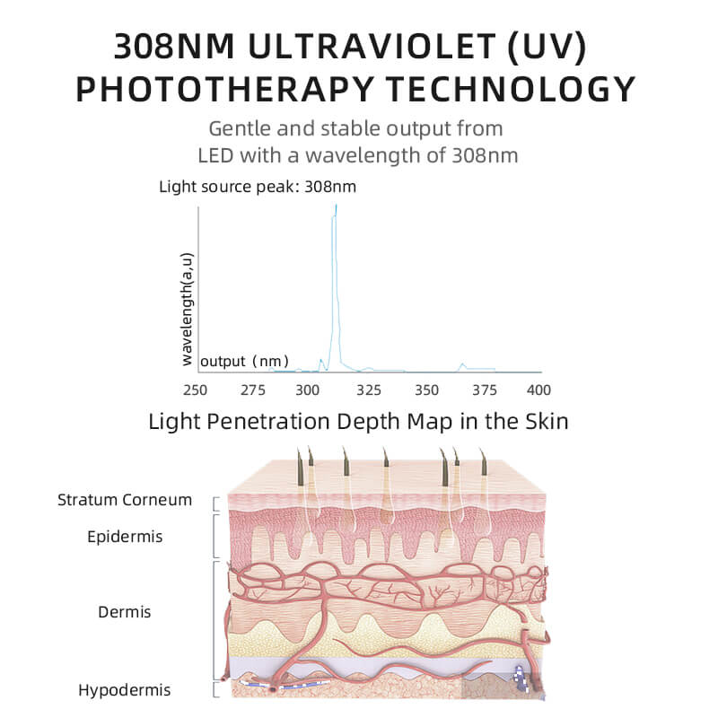 Vitiligo Phototherapy Medical 308nm Uvb Lamp Handheld Light Therapy For Psoriasis Skin Care 2