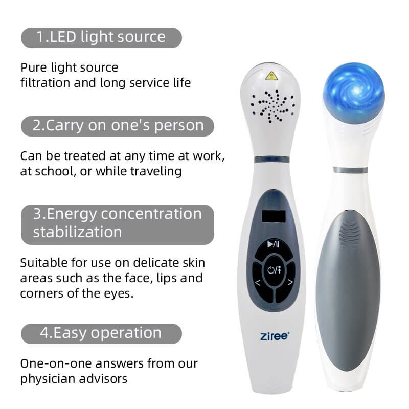 Vitiligo Phototherapy Medical 308nm Uvb Lamp Handheld Light Therapy For Psoriasis Skin Care 4