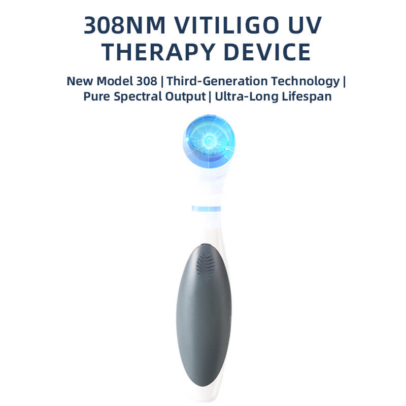 Vitiligo Phototherapy Medical 308nm Uvb Lamp Handheld Light Therapy For Psoriasis Skin Care 6