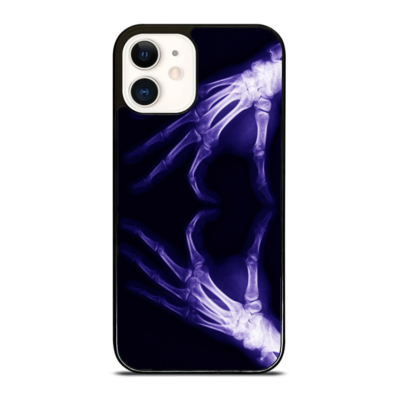 Blue Purple Xray IPhone Case  Stylish  Durable Phone Cover For IPhone Samsung Galaxy And Google Pix 0
